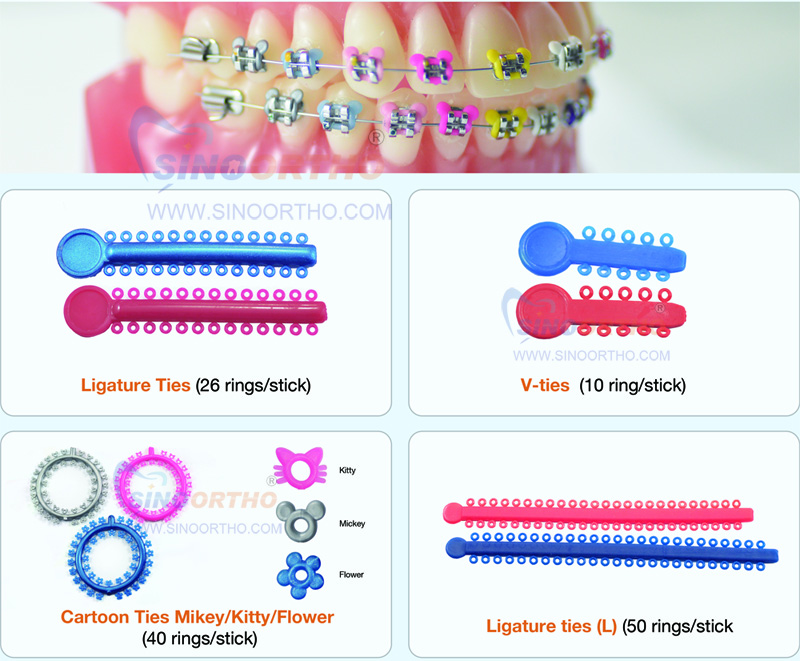 O rings.jpg O rings.jpg
