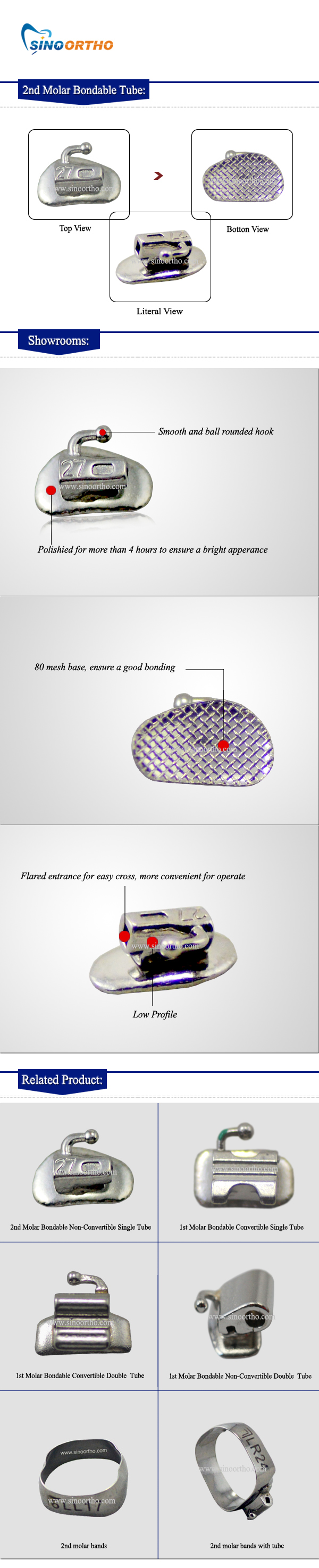 2nd-Molar-Bondble-