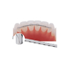Orthodontic Braided Lingual Retainer Wire