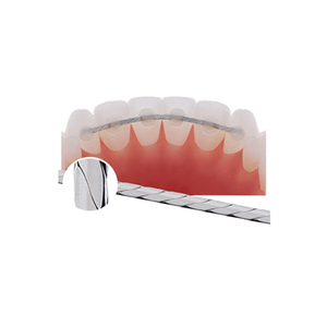 Orthodontic Braided Lingual Retainer Wire